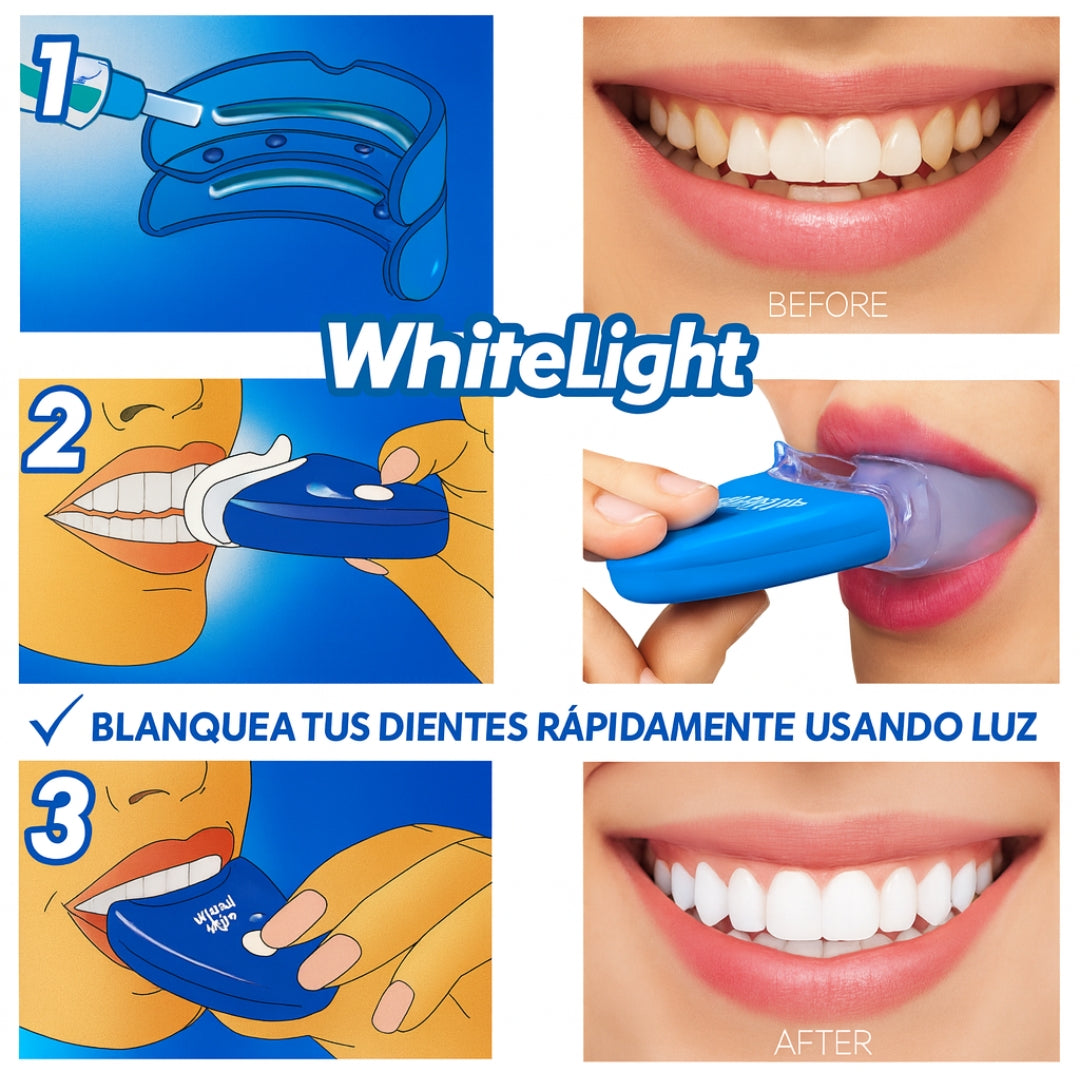 Blanqueador Dental WhiteLight™