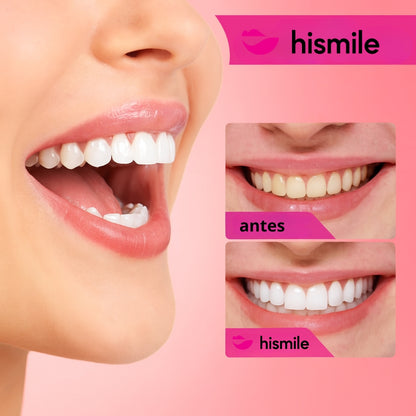 Tiras Blanqueadoras Anti-Sensibilidad HiSmile
